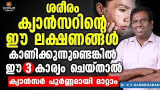 ഈ ലക്ഷണങ്ങൾ കാണിക്കുന്നുണ്ടെങ്കിൽ  ഇങ്ങനെ  ചെയ്താൽ ക്യാൻസർ പൂർണ്ണമായി മാറ്റാം | Cancer Malayalam