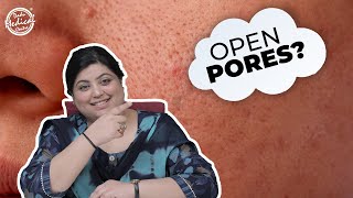 Open Pores | Dr.Nivedita Dadu | #openpores #openporestreatment #shorts #youtubeshorts