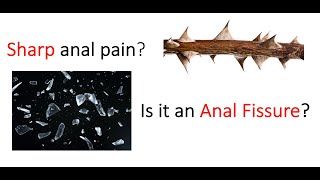 Sharp, stabbing pain in your ANUS? Could it be an anal fissure?