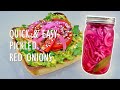 Easy Flavor Enhancer | Pickled Red Onions | Starts With Kitchen