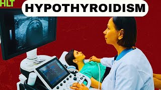 5 Foods To AVOID When You Have Hypothyroidism