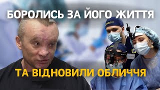 Лікарі місяць боролися за його життя, а згодом відновили і обличчя