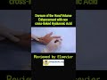 d012 dorsum of the hand volume enhancement with non cross linked hyaluronic acid