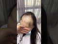 Hair System Transformation | Wig for Alopecia | Bono Hair #shorts