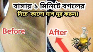 বাসায় ১ মিনিটে বগলের নিচে কালো দাগ দূর করুন। How To Dark Underarms Removal