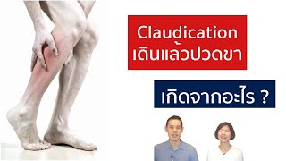 เดินแล้วปวดขา เกิดจากอะไร (Vascular vs Neurogenic claudication) | EasyDoc Family Talk EP.18