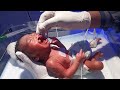 #baby#feeding tube baby #video #banit ke #vlogs