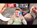 LaVivid Hair System: Tape or Glue - what's best?