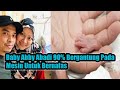 Bayi Abby Abadi Bergantung 90% Pada Mesin Untuk Bernafas