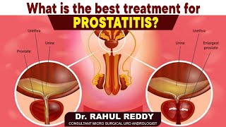 Treatment Options for Prostatitis | Causes of Prostatitis | Dr Rahul Reddy | Socialpost Healthcare
