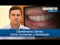 Clareamento Dental. Como Aumentar a Satisfação | Leonardo Muniz