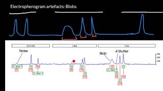 STR Electropherogram artifacts: blobs
