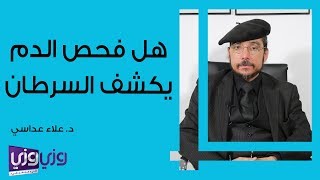 هل فحص الدم يكشف السرطان