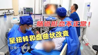 累够呛！老人的肠镜检查做起来非常困难，医生：肠镜检查有大学问