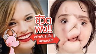 สาวสวยที่หน้าพังภายในพริบตา เพราะตัดสินใจทำสิ่งนี้ #ดาร์คไดอะรี่ I แค่อยากเล่า...◄1509►