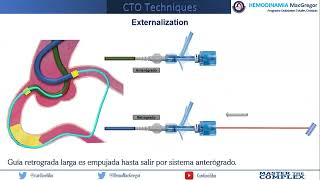 Externalization