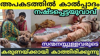 അപകടത്തിൽ കാൽപ്പാദം നഷപ്പെട്ടയുവാവ് ചികിത്സാസഹായംതേടുന്നു | Accident Foot Remove Man| Oyoor |Kollam|