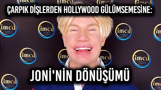 Çarpık Dişlerden Hollywood Gülümsemesine: Joni'nin Dönüşümü