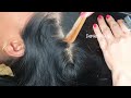 dandruff scratching removal with soft asmr hair scalp check 119