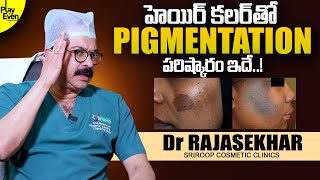 Hair Color Pigmentation Solution | Dr Rajasekhar | Face \u0026 Neck Pigmentation Treatment | PlayEven