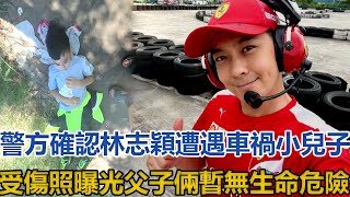 警方確認林志穎遭遇車禍，小兒子受傷照曝光，父子倆暫無生命危險#林志穎