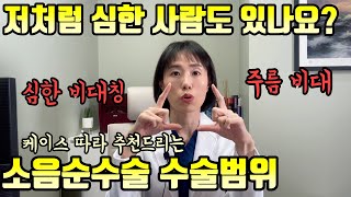 저 너무 심한데 얼마 나오나요? (진찰해보면 전혀 아님) 수술 범위 어떻게 정하는지 알려드려요. 我太嚴重了這樣要多少錢? (診察後發現根本不嚴重) 告訴你手術範圍是怎麼定的【한중/韓中 】