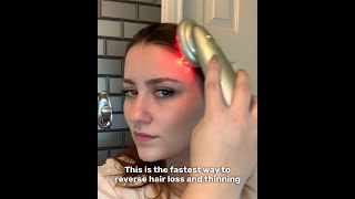 Reverse \u0026 Prevent Hair Loss In 4 Weeks