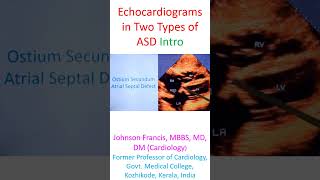 Echocardiograms in Two Types of ASD