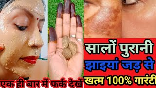 How To Remove Pigmentation सालो पुरानी झाइयों के निशान हटाएं सिर्फ 7 दिनों में |#glowingskin