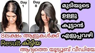 മുടിയുടെ ഉള്ളു കൂട്ടാൻ എളുപ്പവഴി |100% Natural |ഒരു ingredient മാത്രം മതി|8ലക്ഷം ആളുകൾക്ക് റിസൾട്ട്‌