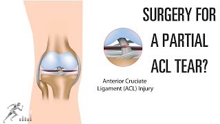 Do you need surgery for a partial ACL tear?