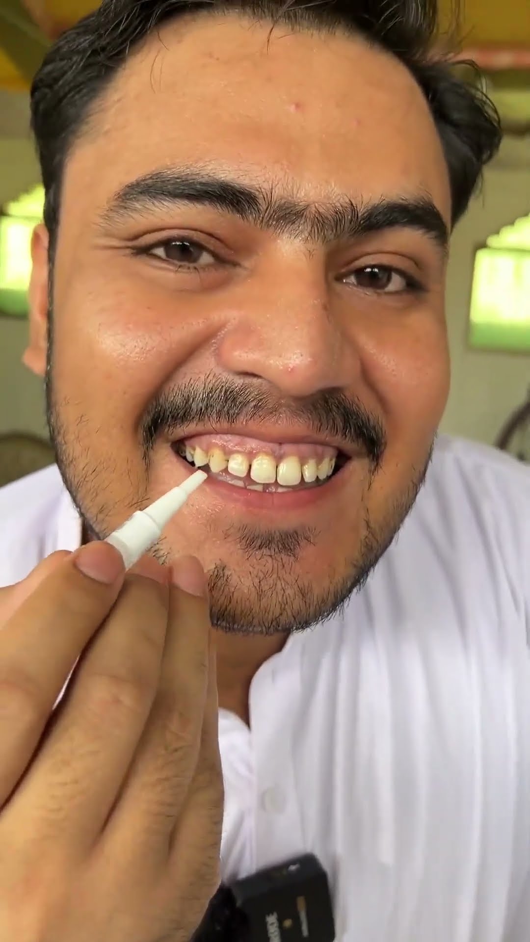 Ultra Instant Teeth Whitening Stick Review