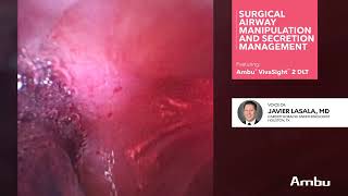 Surgical Airway Manipulation and Secretion Management | Dr.  Lasala Using the VivaSight™ 2 DLT