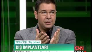 Diş implantları dişe nasıl uygulanır?