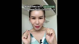 #ข่าวบิวตี้ ขอเสนออาหารเสริมลดบวมช้ำหลังทำศัลยกรรม👃🏻 #หลังศัลยกรรม