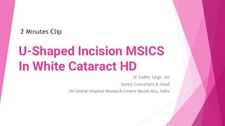 2 Minutes Video: U-Shaped Incision MSICS In White Cataract HD (Unedited)