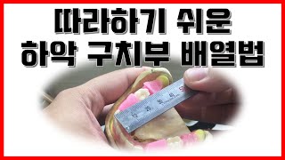 [이상진ch] 따라하기 쉬운 하악구치부 배열법