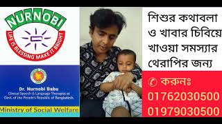 শিশু চিবিয়ে খায়না সমস্যার থেরাপি ডাঃ নূরনবী বাবু