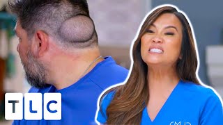 Bodybuilder Struggles With Low Self-Esteem Because Of Large Bump On His Head | Dr. Pimple Popper