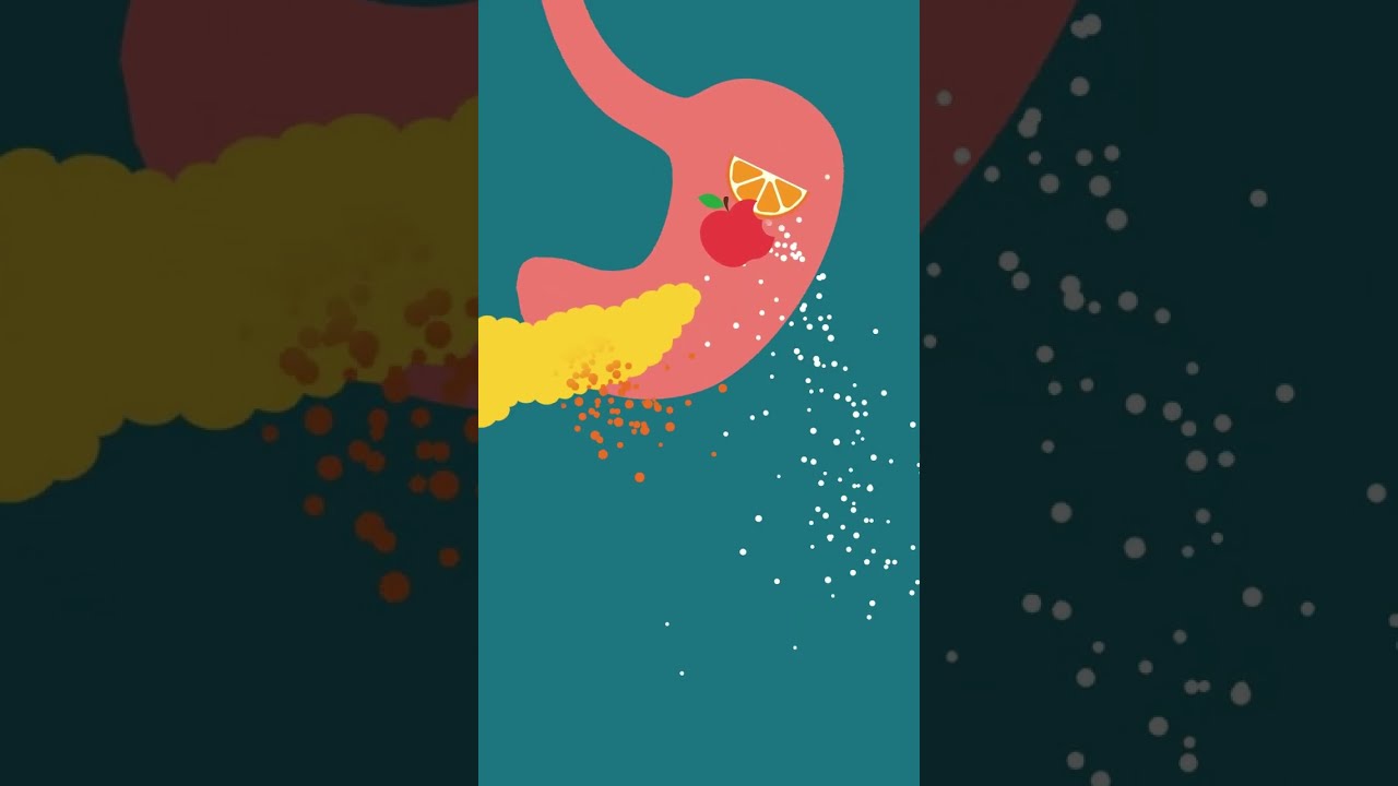 Explaining Insulin Resistance Diabetes