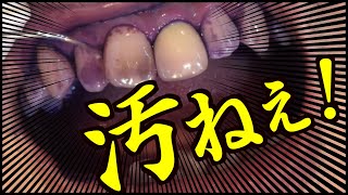 歯磨きの仕方、方法、やり方は正しいか？チェックしました。歯周病や口臭、虫歯を予防は歯磨き力が鍵です。