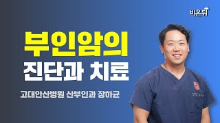 부인암의 진단과 치료 / 고대안산병원 산부인과 장하균