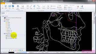 AudaxCeph - Cephalometric Analysis type geometry