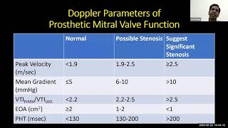 Philips Echo Webinar Series Evaluation of Prosthetic Mitral Valve by Jesu Krupa, CMC Vellore