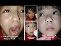 Drama Emma Jatuh Berdarah... Anak Nangis...