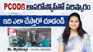 PCODకి లాపరోస్కోపీ || Laparoscopic Surgery for PCOD || PCOS Solution || Mythri Sri Fertility Centre