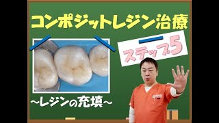 コンポジットレジン治療の流れ⑤【王子本町歯科クリニック】