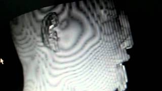 VTK Human Head Visualization 3