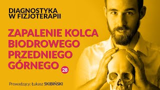 Zapalenie kolca biodrowego przedniego górnego. Diagnostyka w fizjoterapii. Odcinek 28