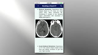 CNS App